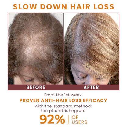 PuraGinger PRO HairReborn AntiThinning Shampoo